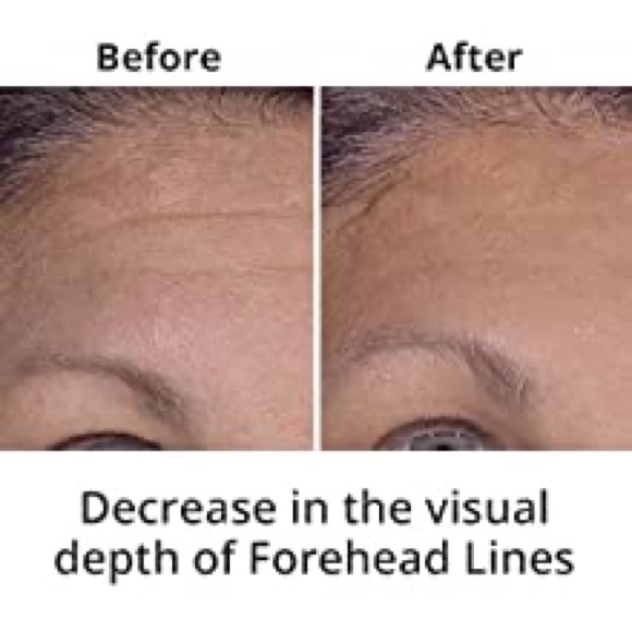 ⚜️Plexaderm Skin Care Rapid Reduction Serum! - Picture 8 of 8